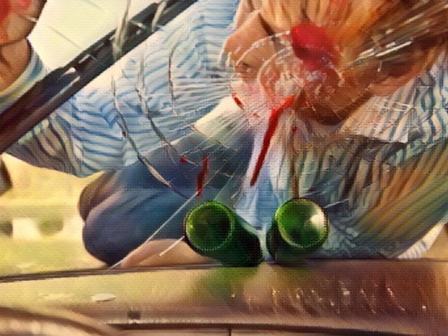 Wounded pedestrian with his head on the smashed windscreen of a car