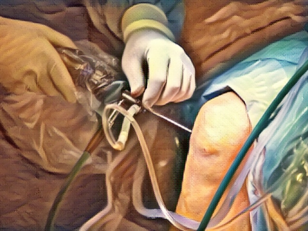 Orthopedic doctor performing arthroscopic knee surgery