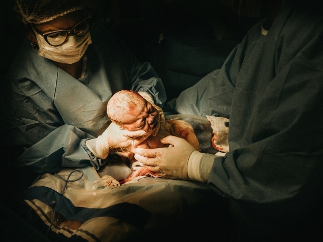 Woman giving birth via C-section with a nurse and a doctor