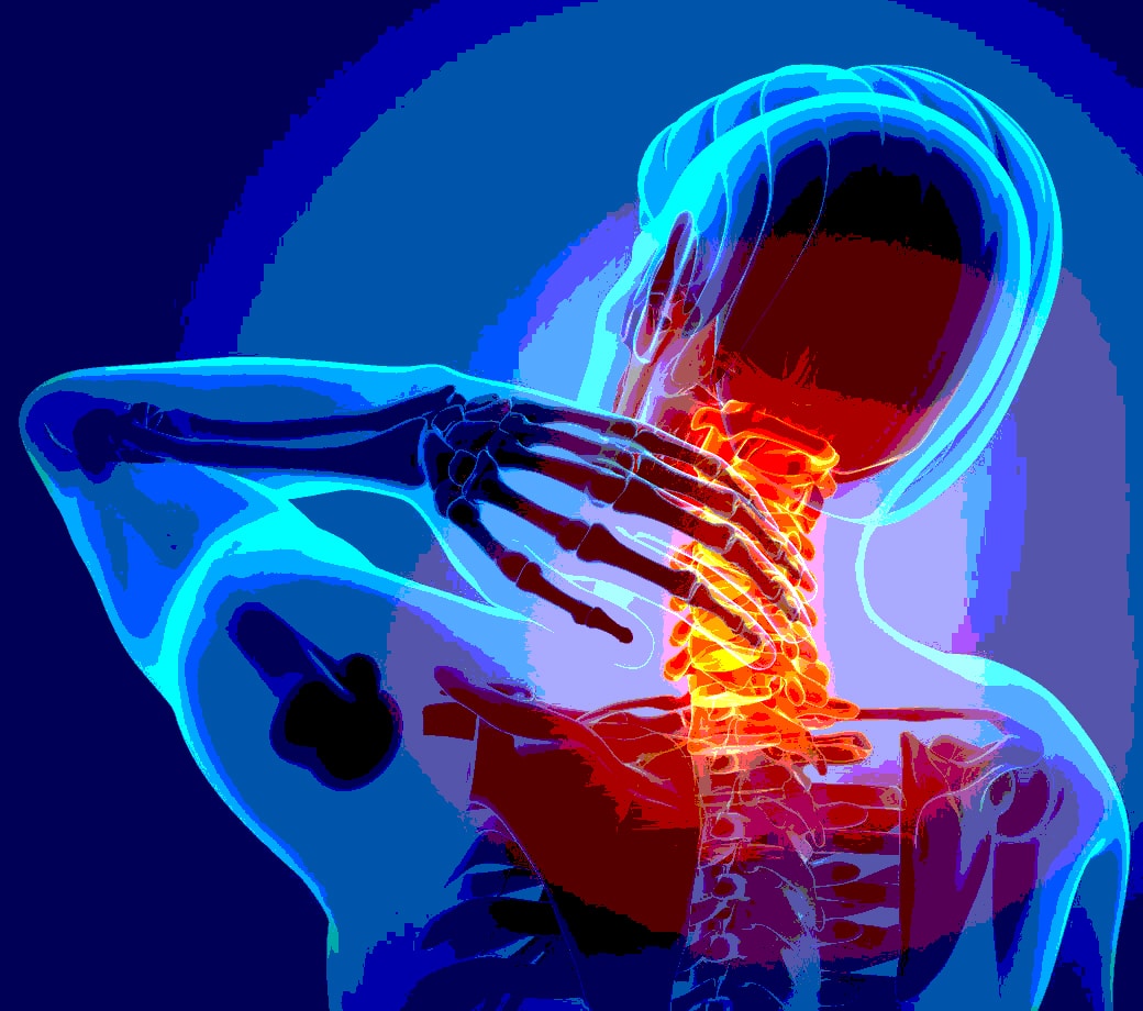 Neck Injury 2014