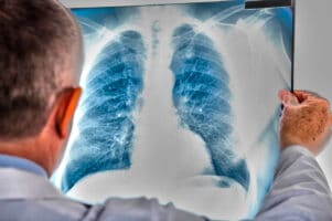 What to Do if You Have Been Misdiagnosed