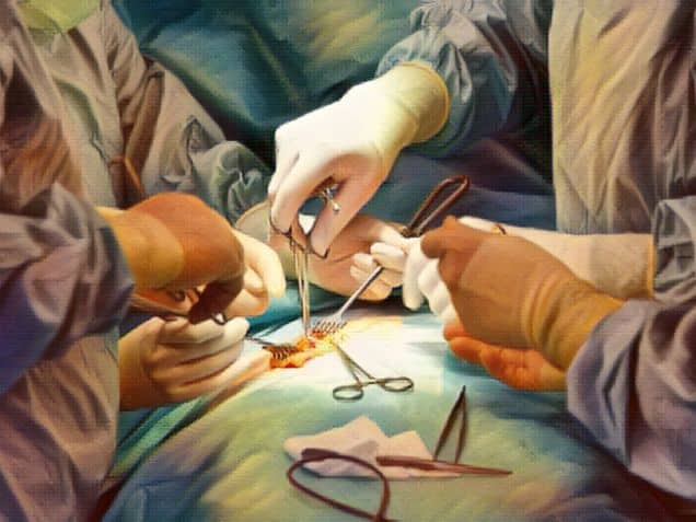 Close-up of a surgery team in German hospital