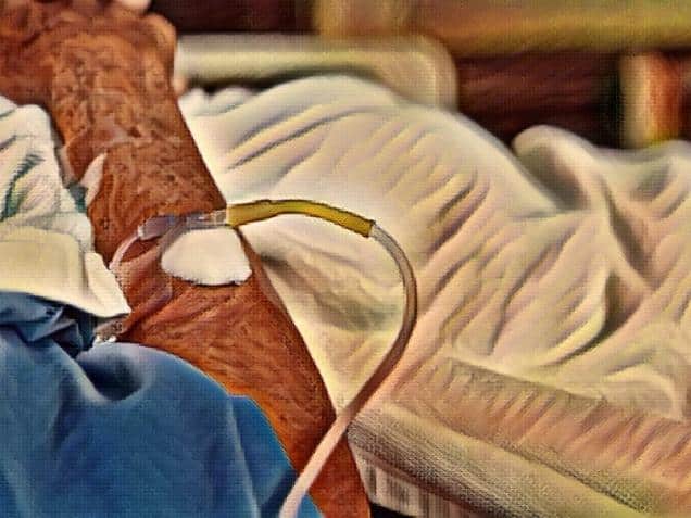 an elderly man's arm wearing a patient's uniform is lying in a bed in a hospital