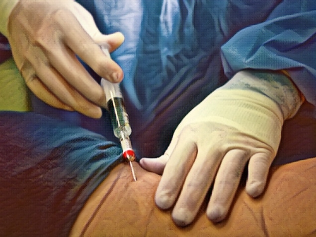doctor Injecting anesthesia