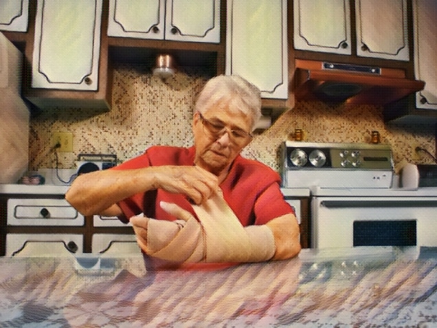 An elderly wrapping her arm with a bandage in her kitchen. Concept of how long does a personal injury lawsuit take