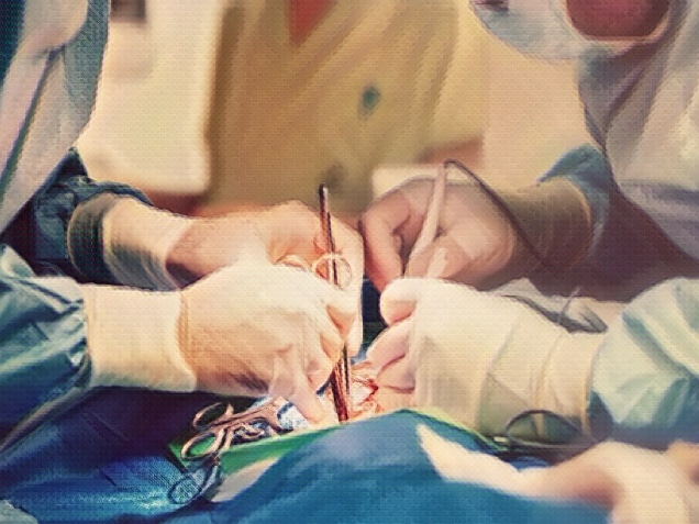 Medical team of surgeons in hospital doing minimal invasive surgical interventions. Concept of retained foreign body
